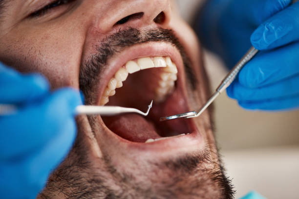 Best Dental Fillings (Composite and Amalgam)  in Mount Carmel, PA